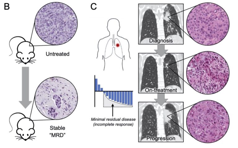 Emerging Insights Into Targeted Therapy-Tolerant Persister Cells In ...